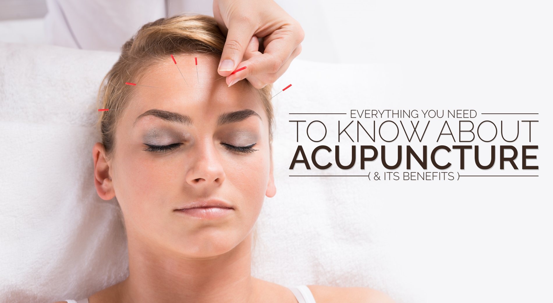 Acupuncture and its amazing benefits Gurugram Naturopathy Cure Centre